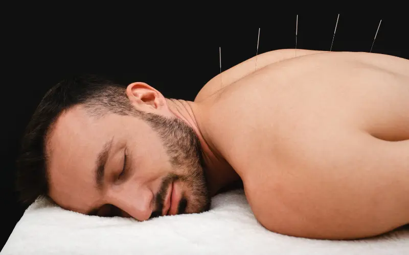 Acupuntura para ansiedade: como as agulhas podem trazer equilíbrio emocional
